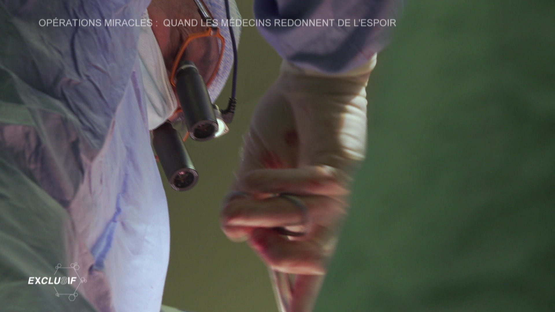 Exclusif - Opérations miracles : quand les médecins redonnent de l'espoir
