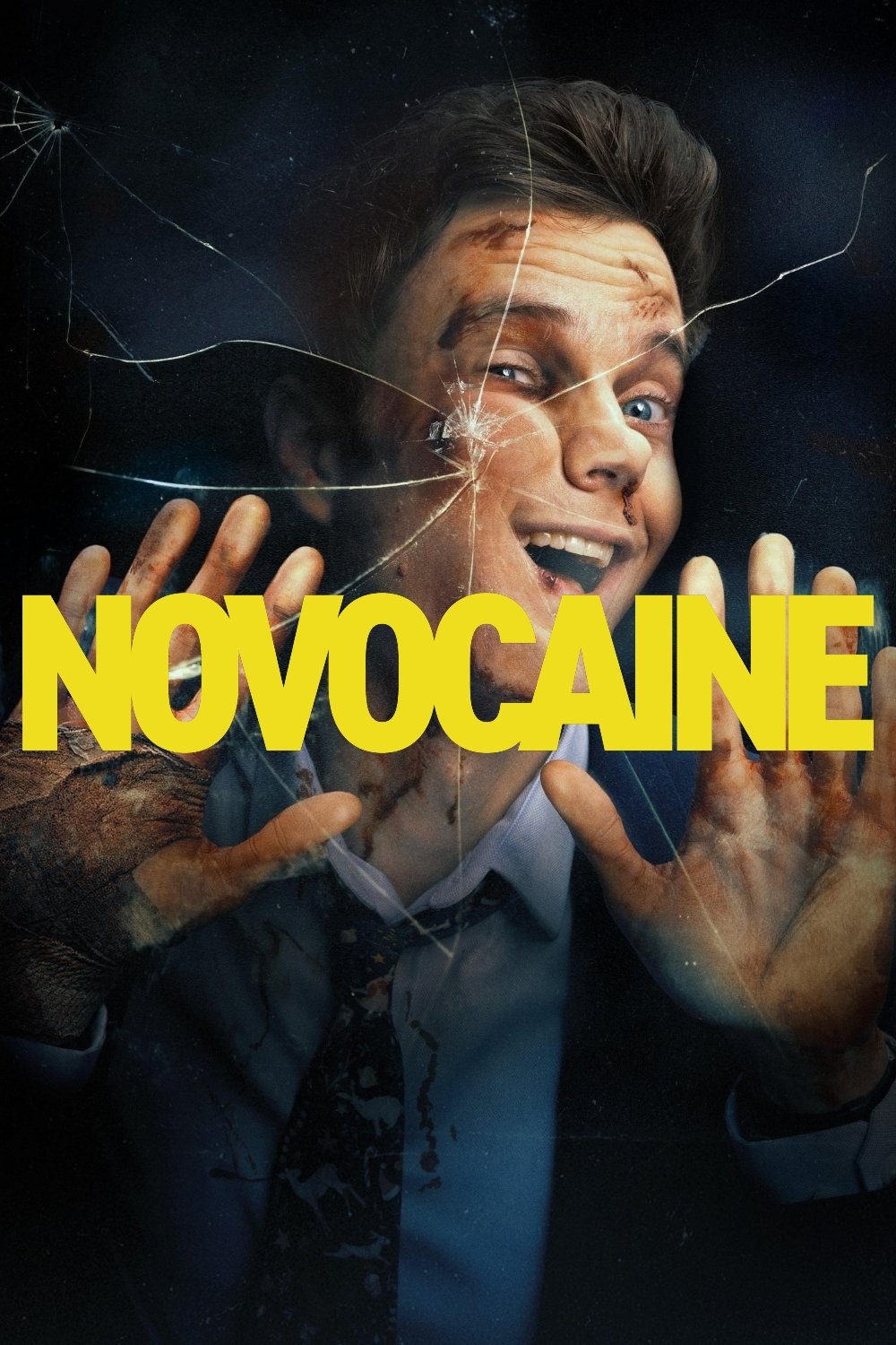 Novocaine
