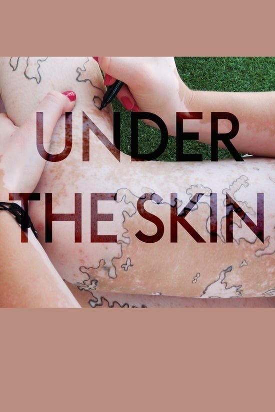 Under the Skin