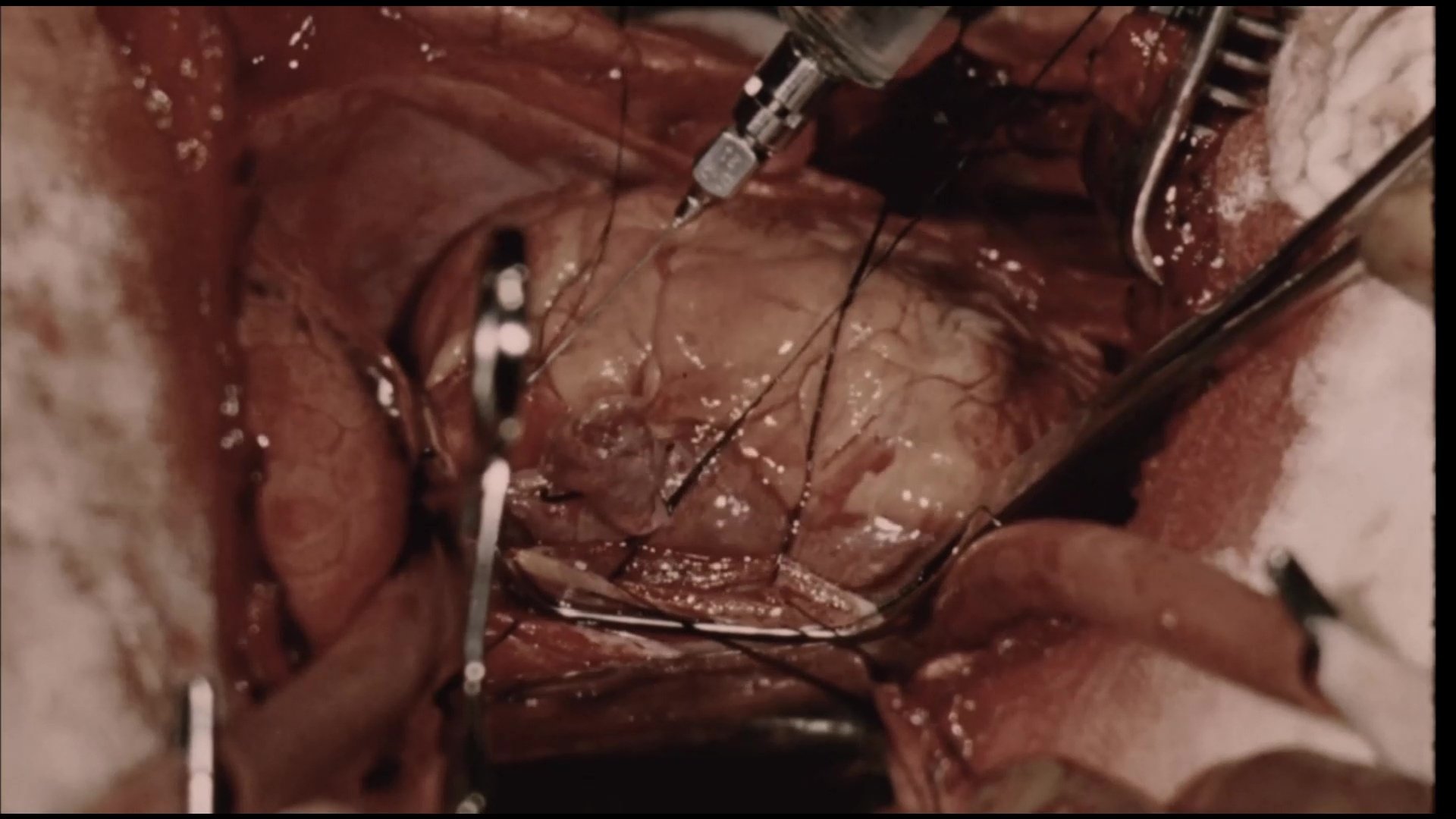 Canadian Made Season 1 :Episode 14  Medical Breakthroughs