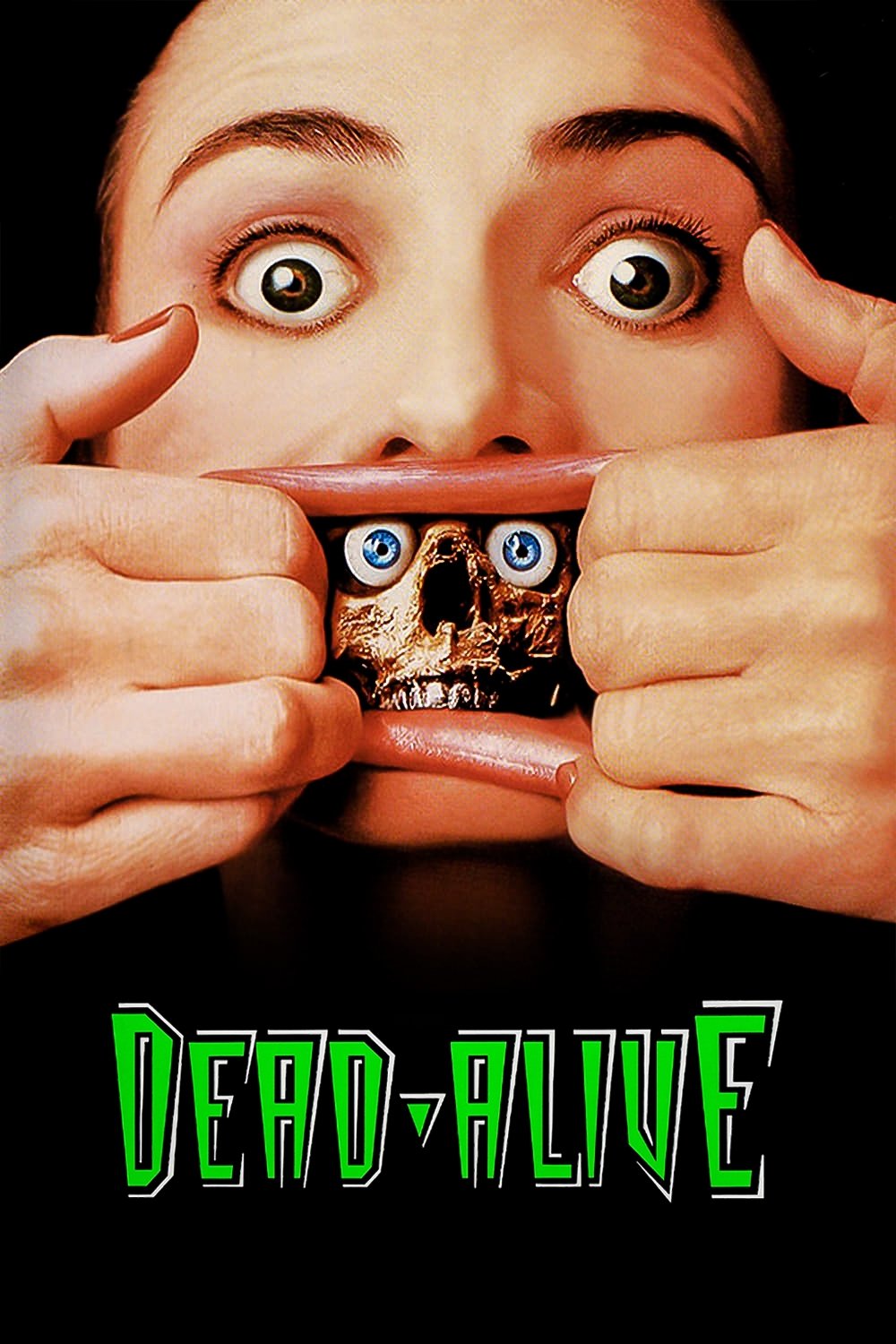 Braindead