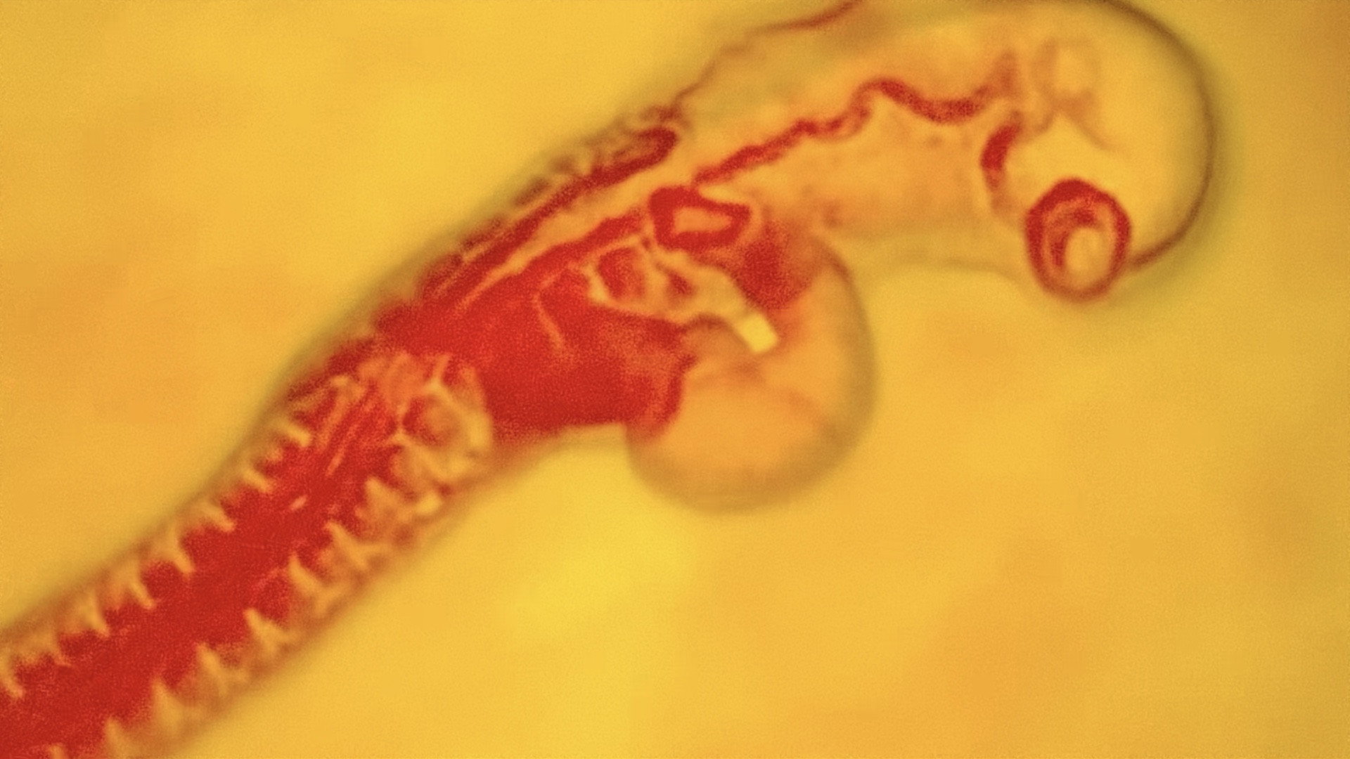 Purgatory for Epiphanea