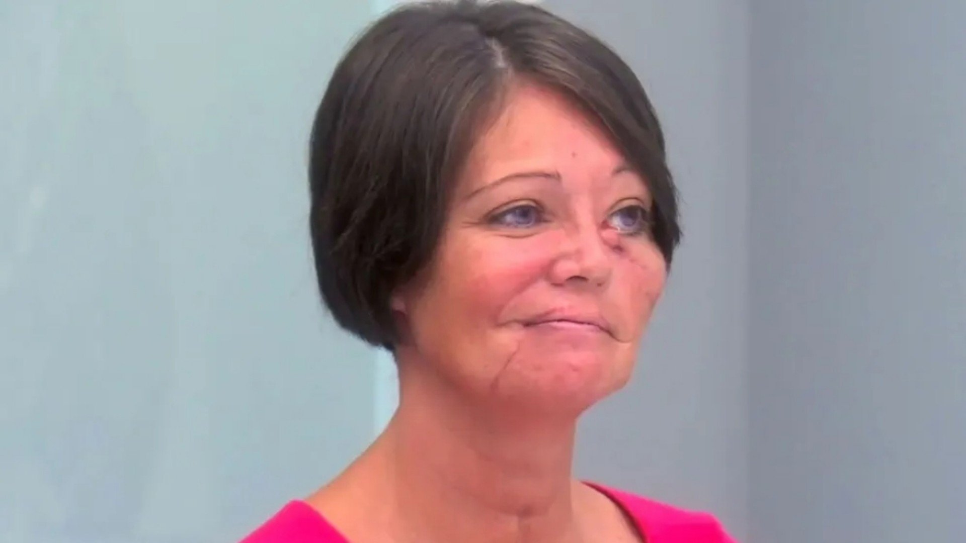 Botched