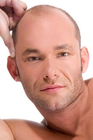 et billede af Dawson