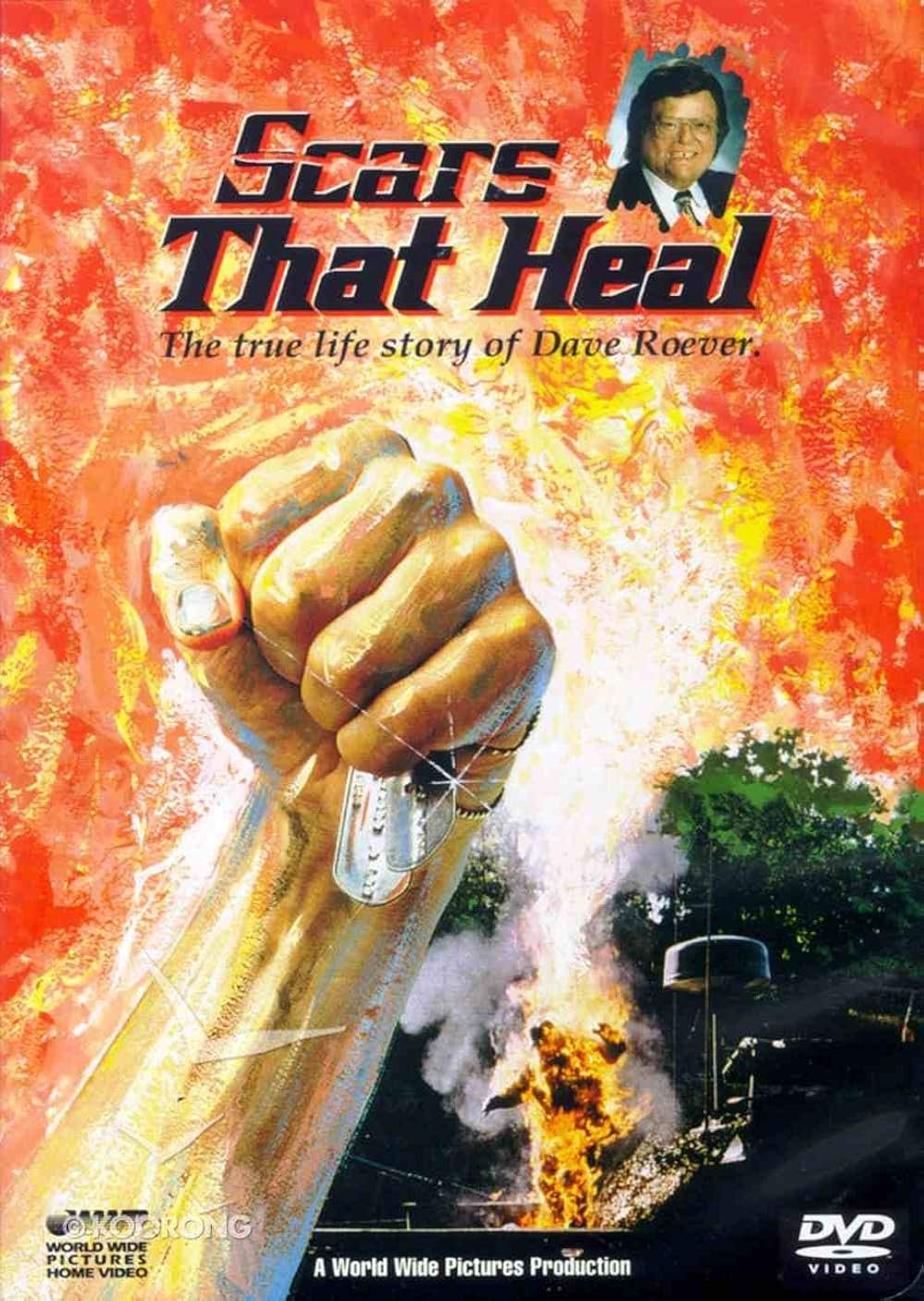 Scars That Heal: The Dave Roever Story Scars That Heal: The Dave Roever Story