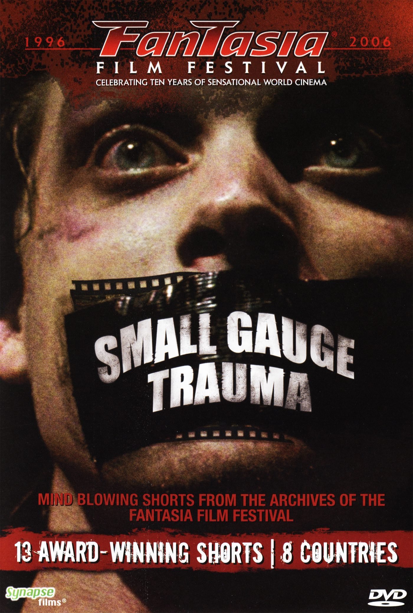 Small Gauge Trauma