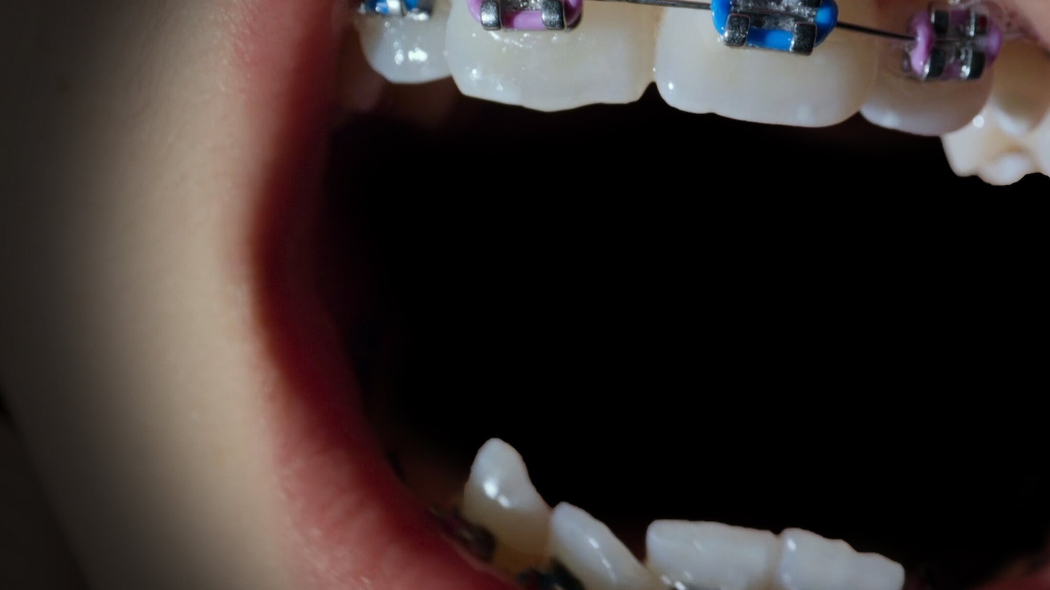 Open Wide (2024)