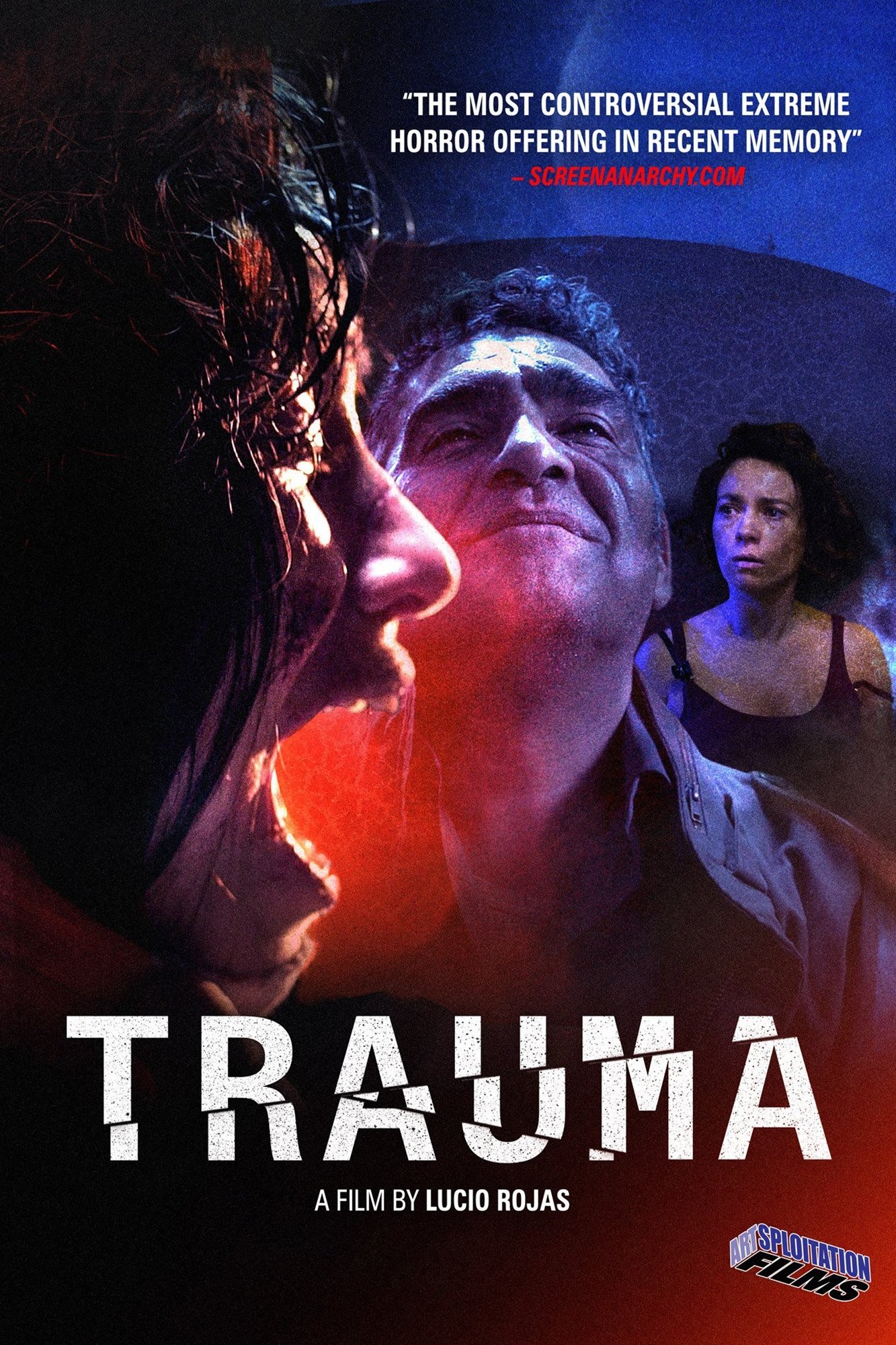 Trauma