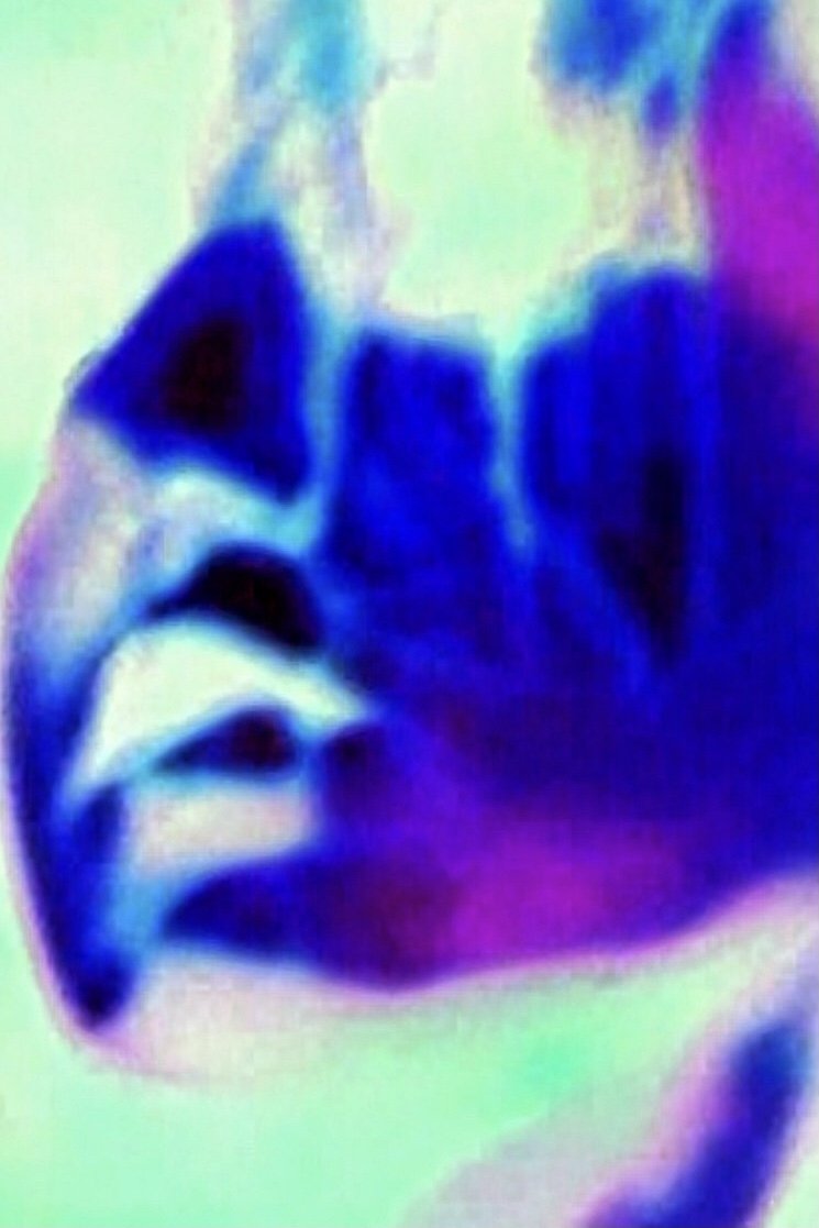 Content cover