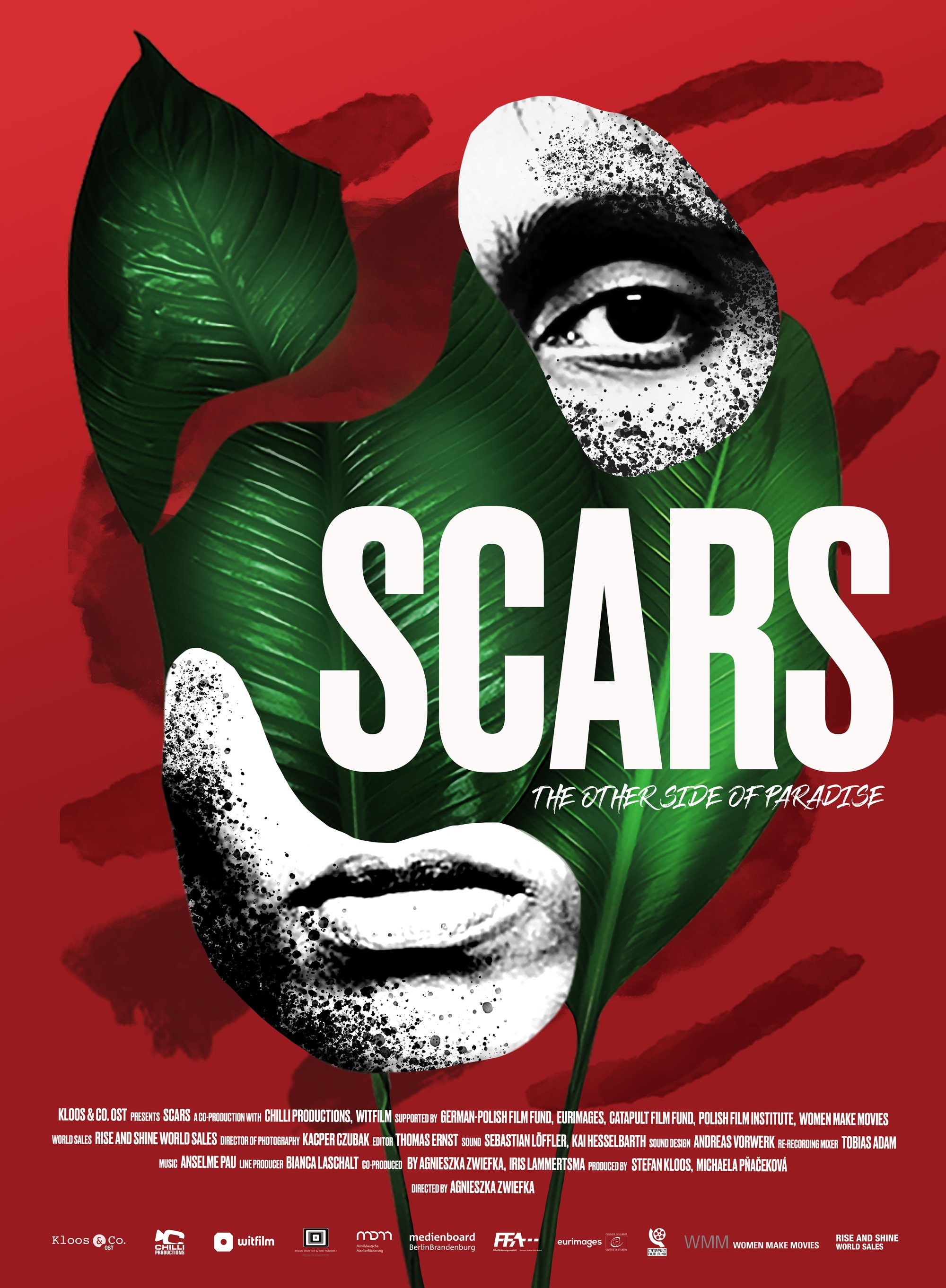 Scars