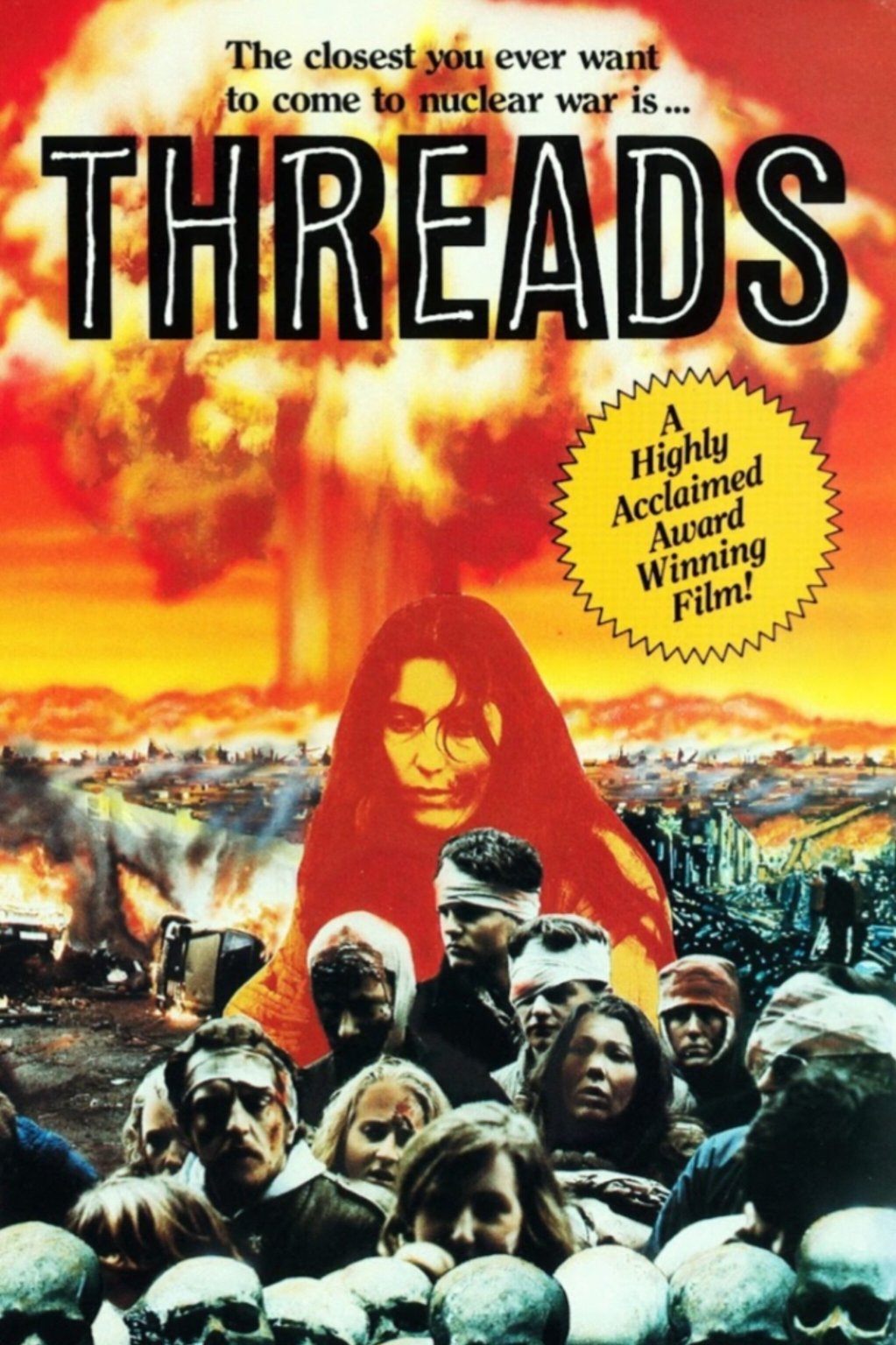 Threads