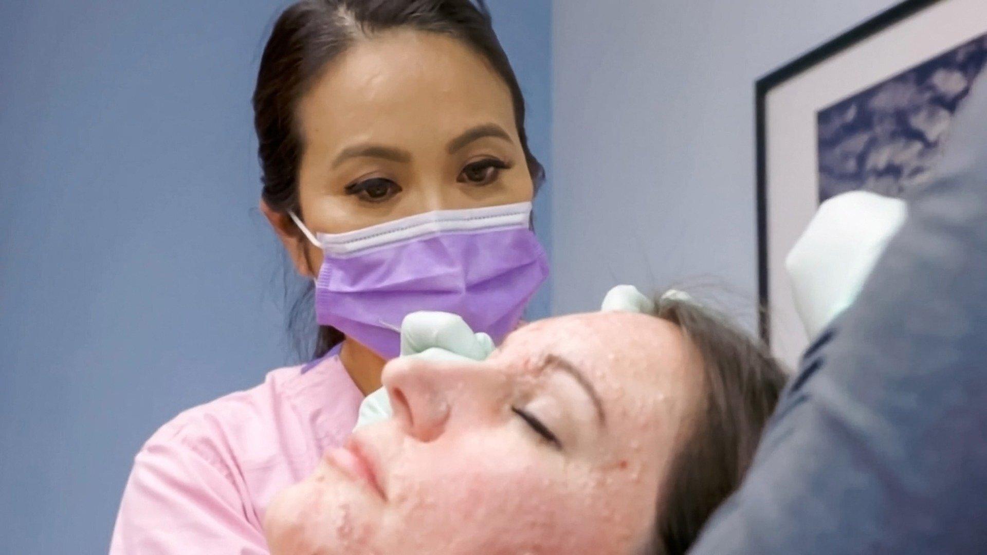 Dr. Pimple Popper - Pédoncules