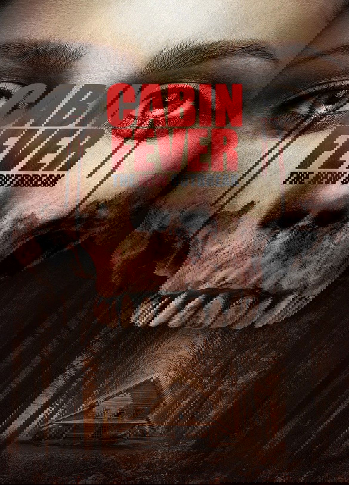 Cabin Fever