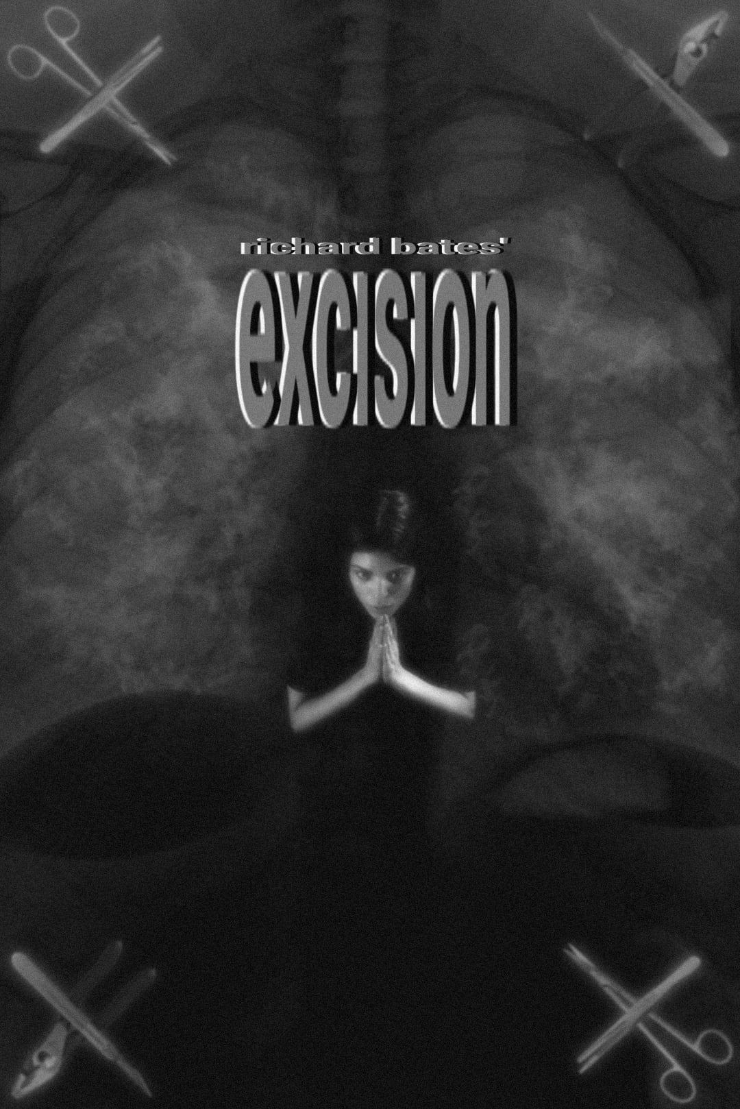 Excision