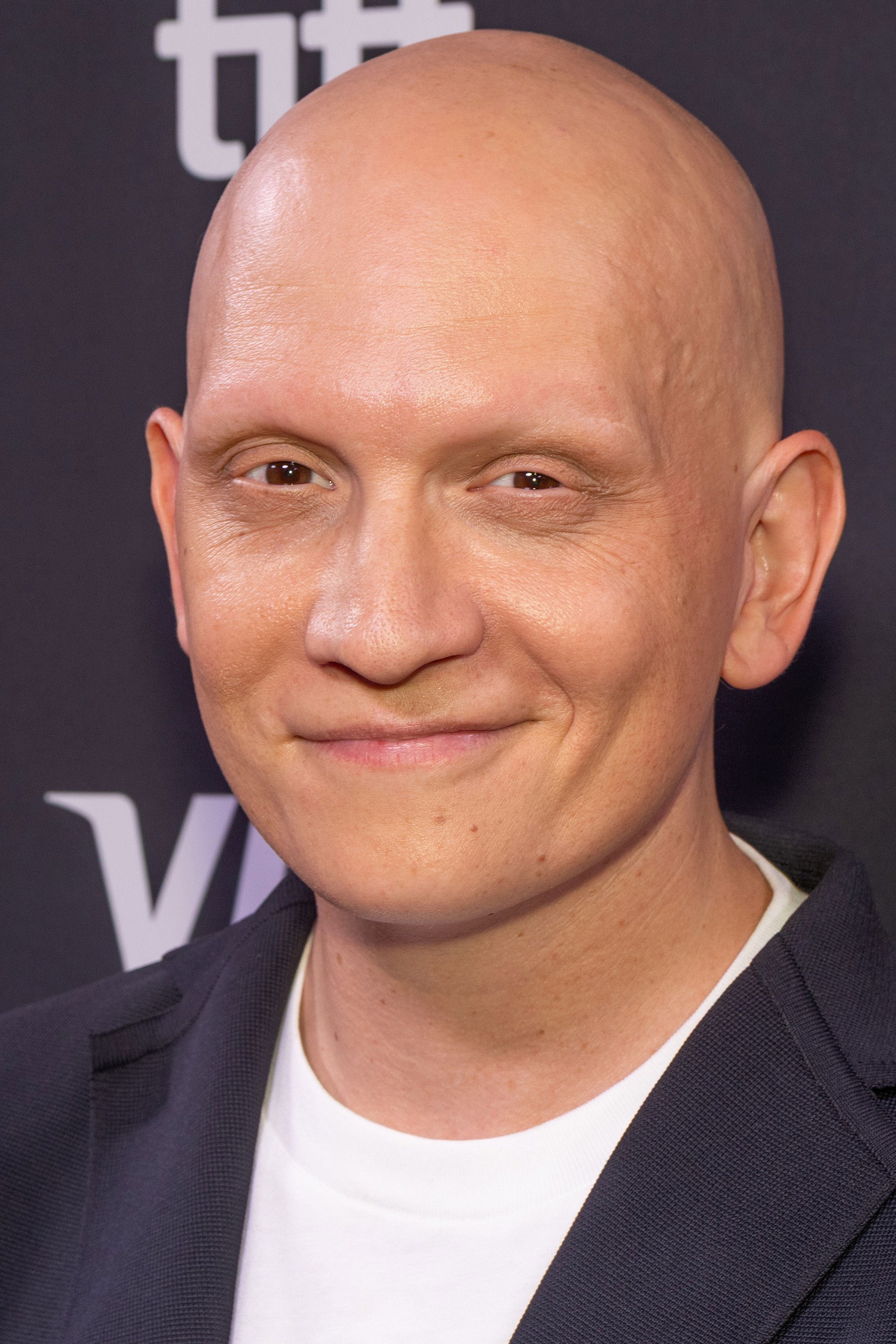 et billede af Anthony Carrigan
