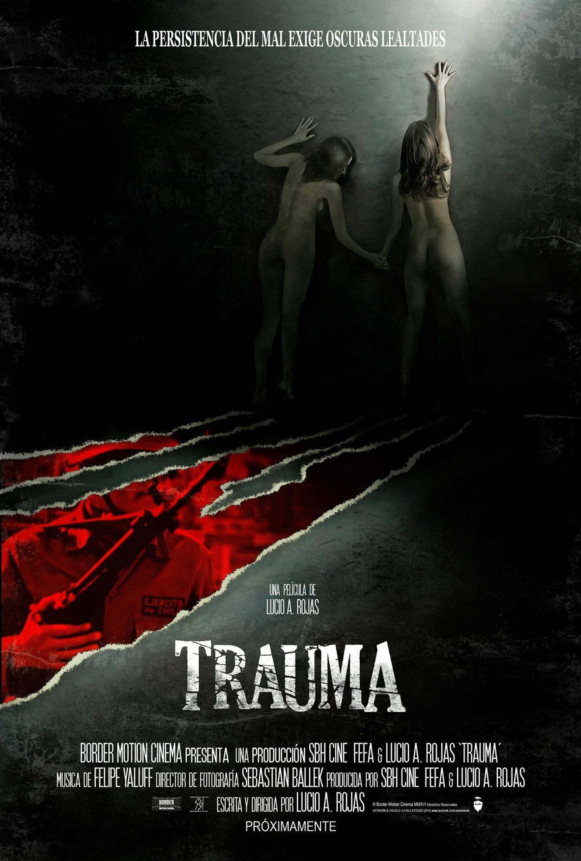 Trauma