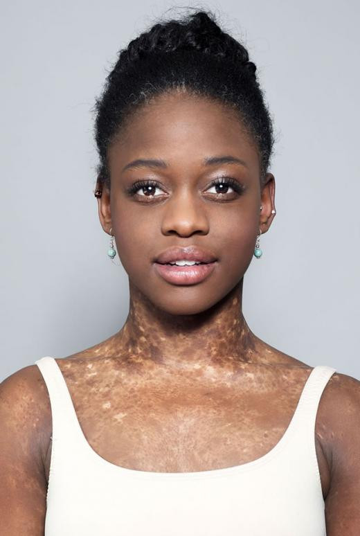 et billede af Michaela DePrince