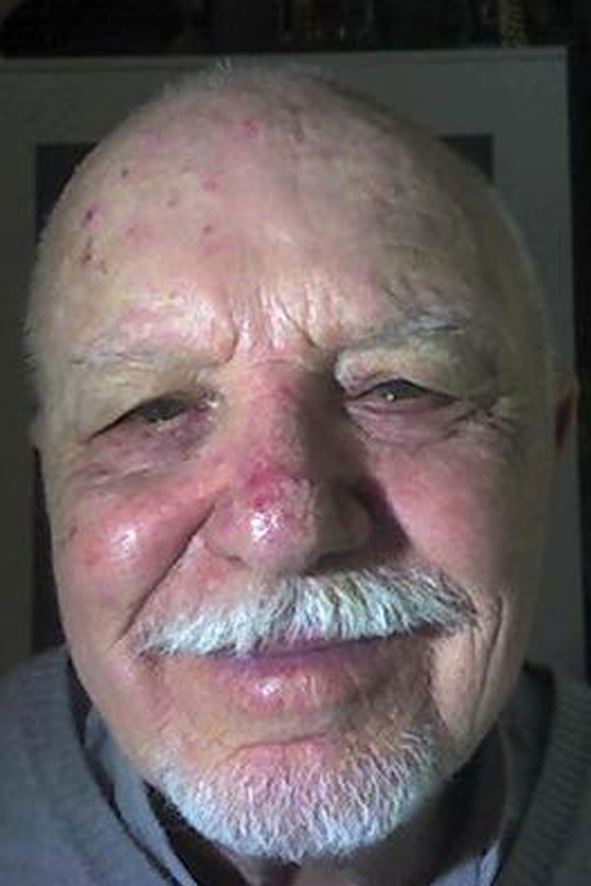 et billede af Pedro Stocki