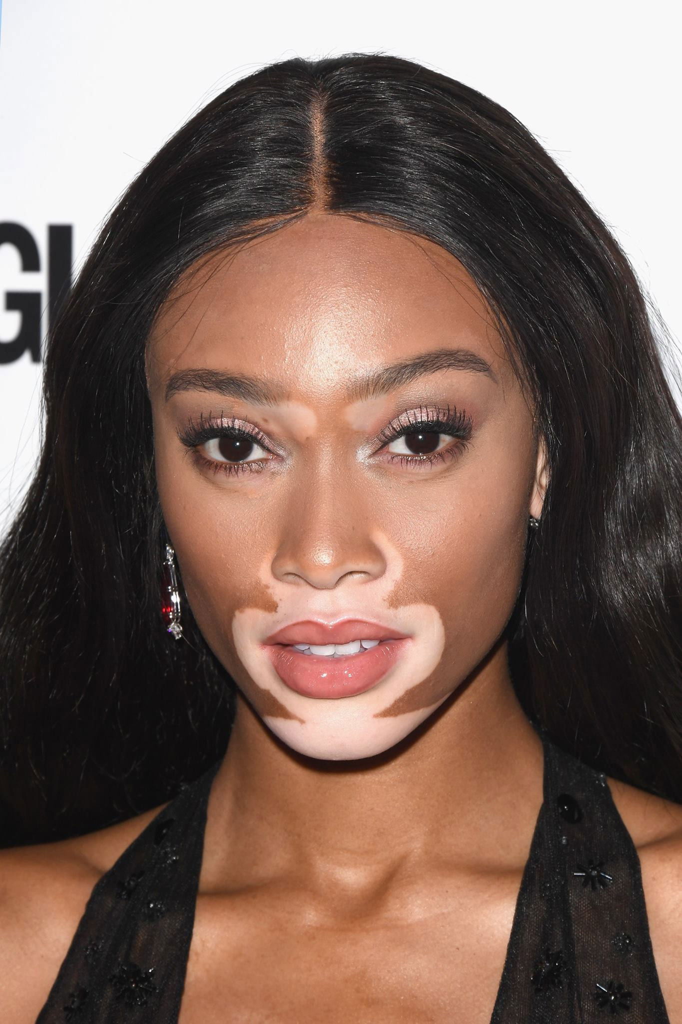 et billede af Winnie Harlow