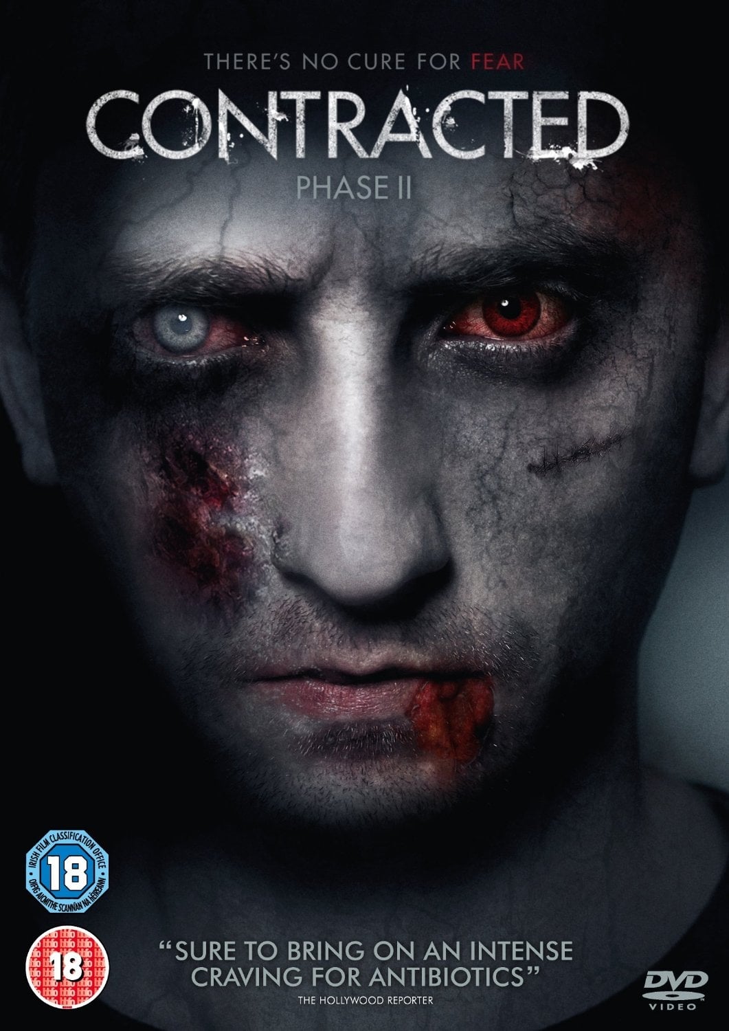 Contracted - Phase II streaming