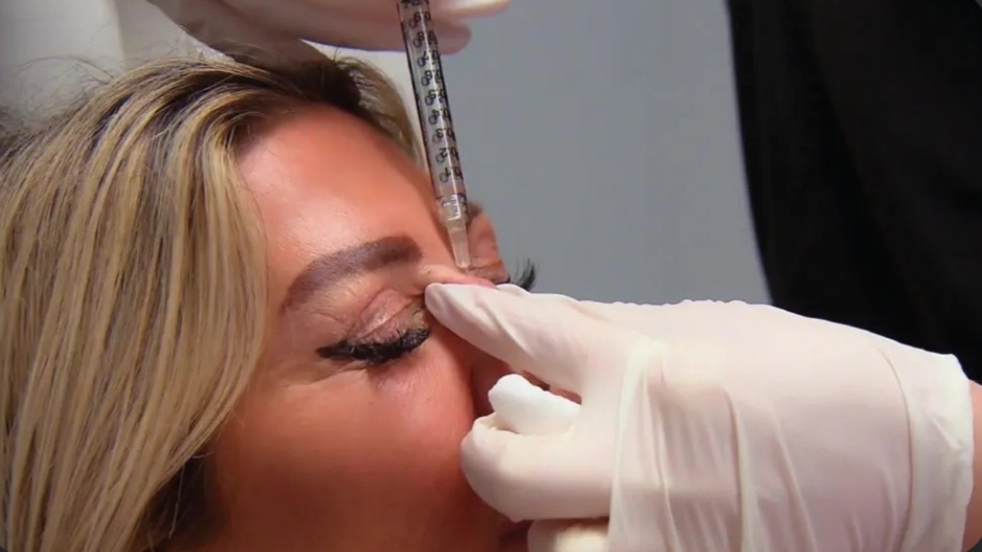 Botched