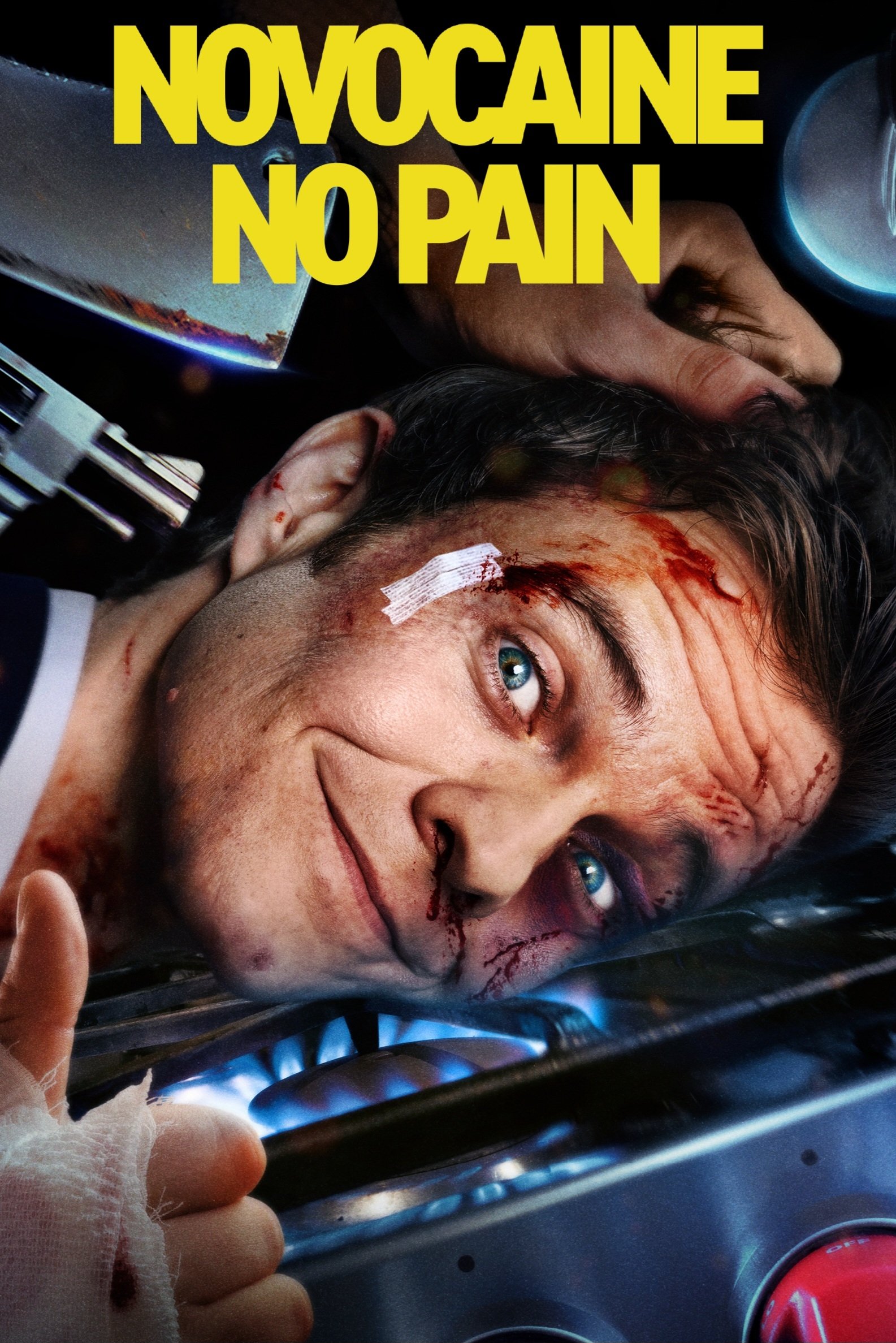 Novocaine