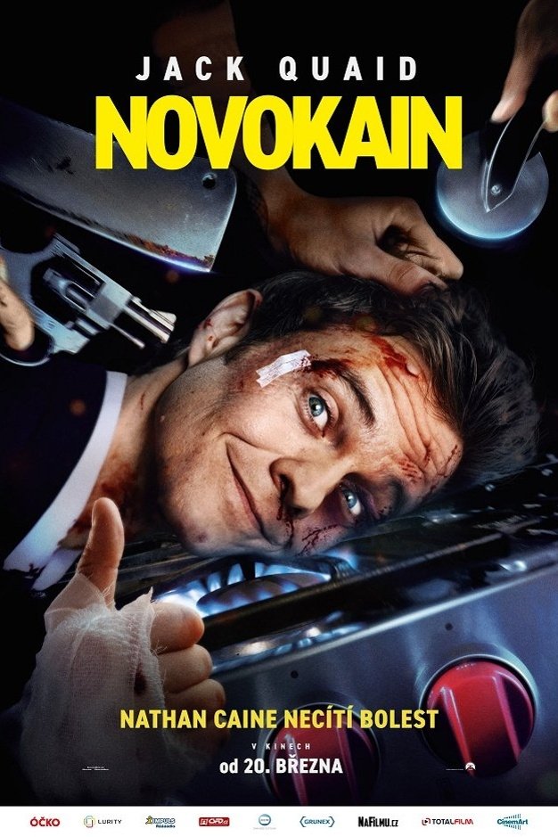 Novokain (2025)