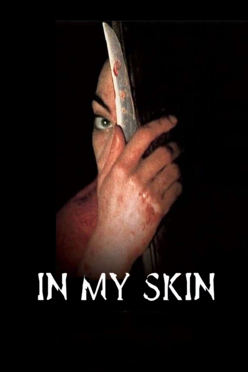 In My Skin