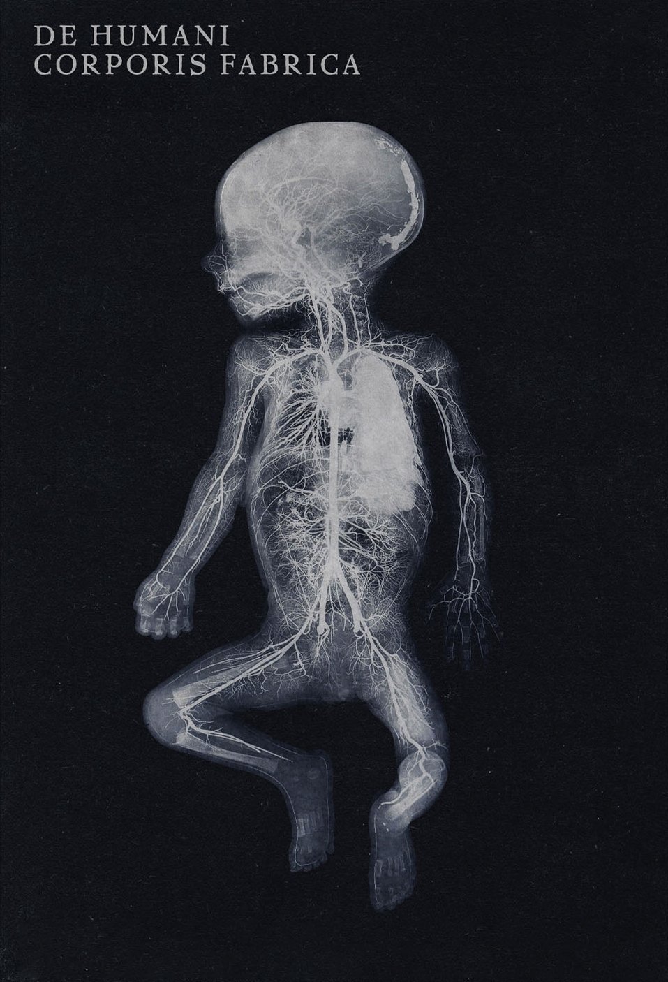 De Humani Corporis Fabrica