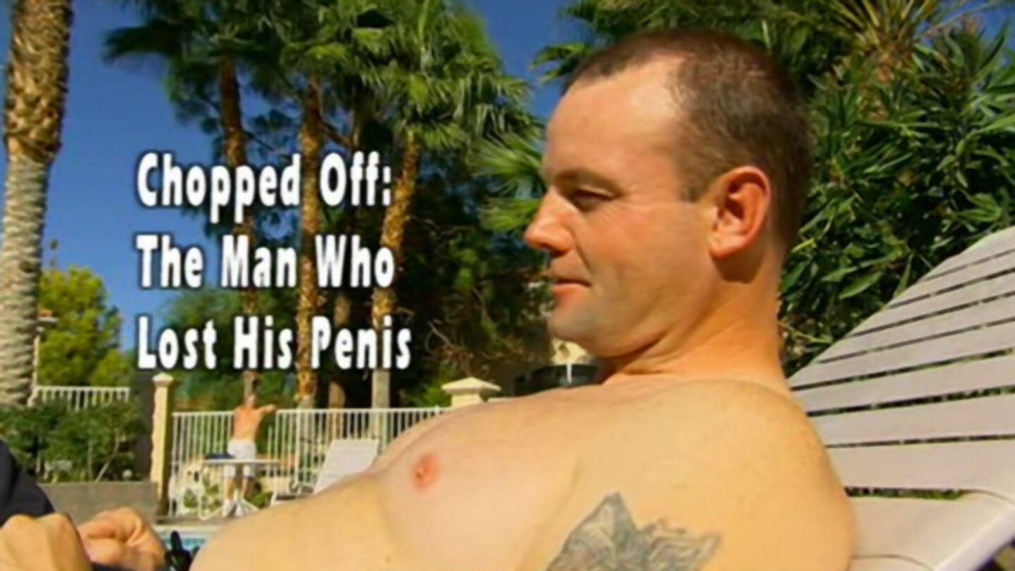 Chopped Off: The Man Who Lost His Penis (2006)