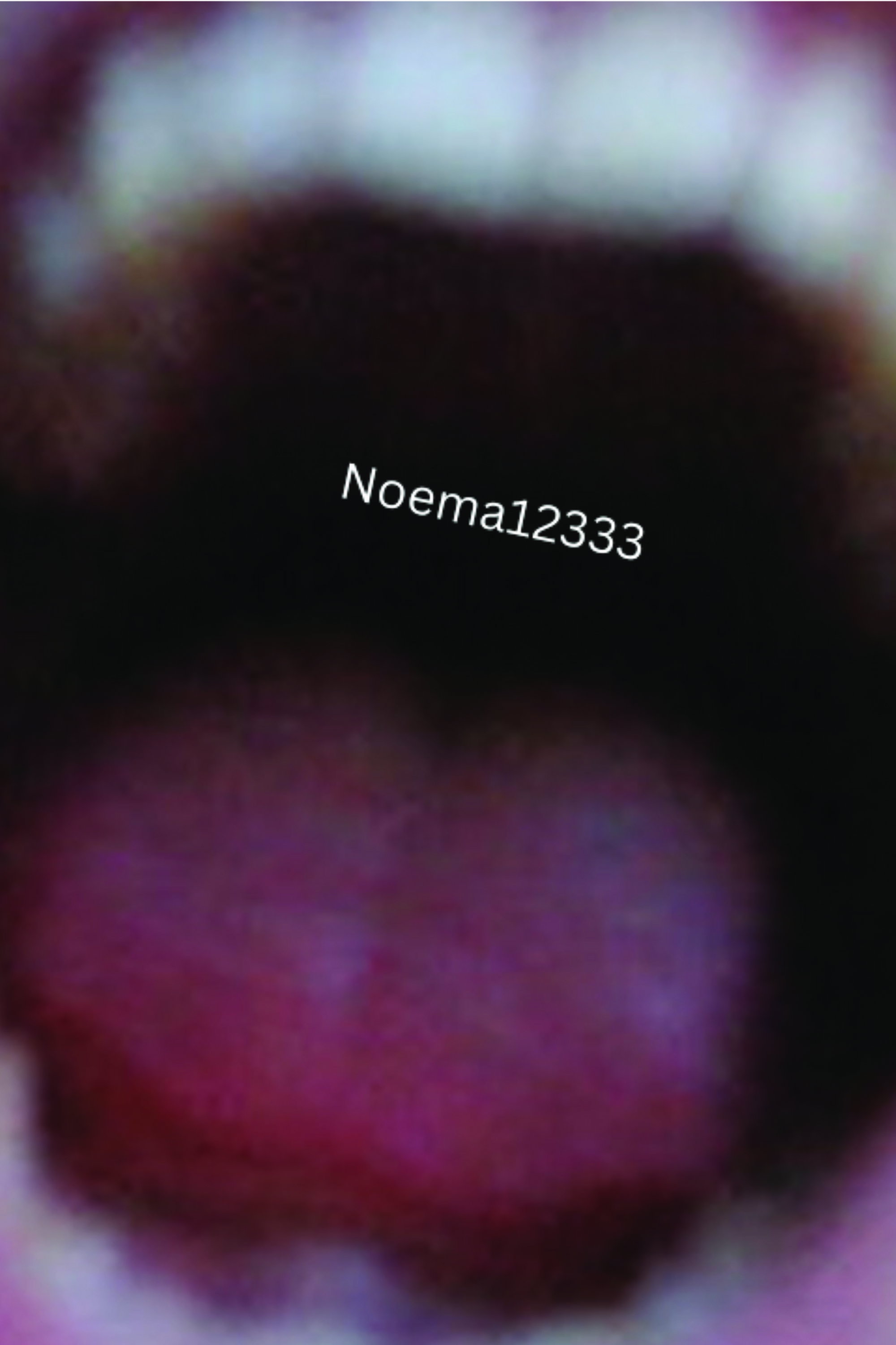 Noema12333