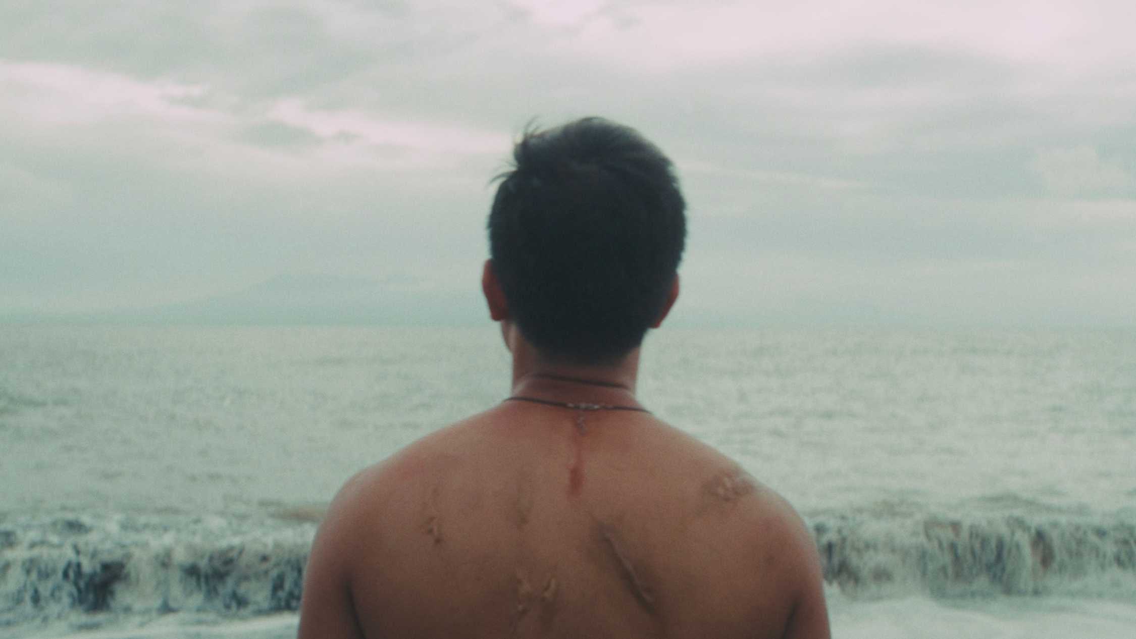 Starfish