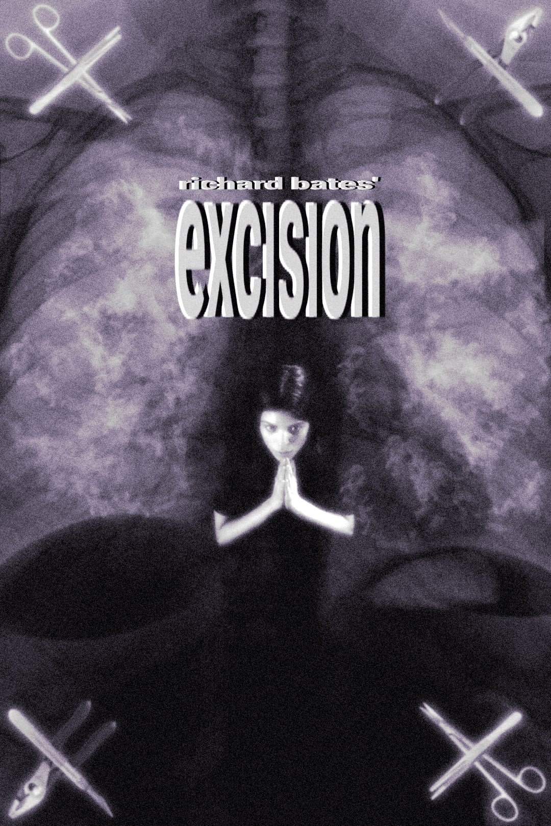 Excision