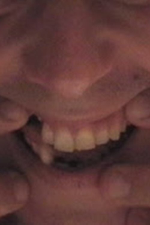 Content cover