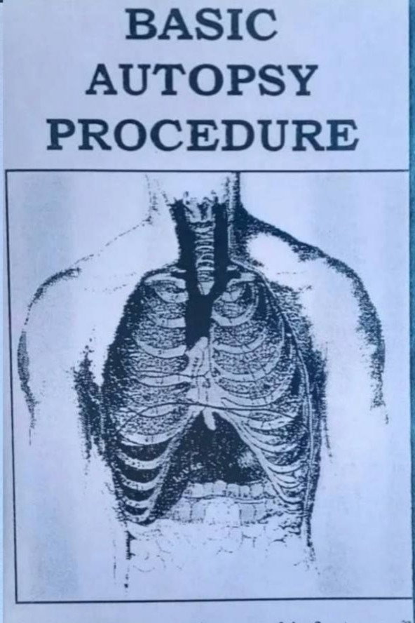 Basic Autopsy Procedure