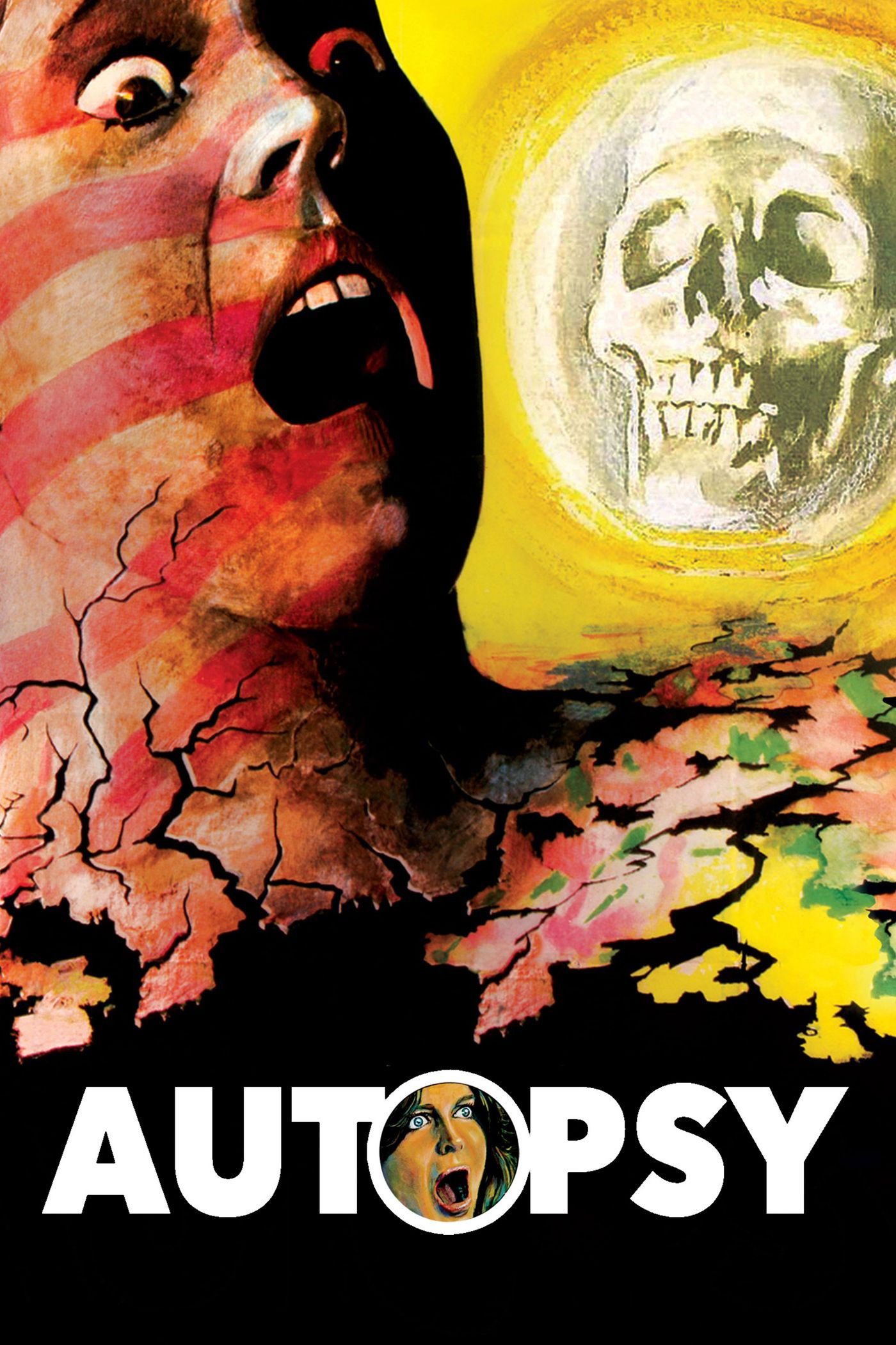 Autopsy