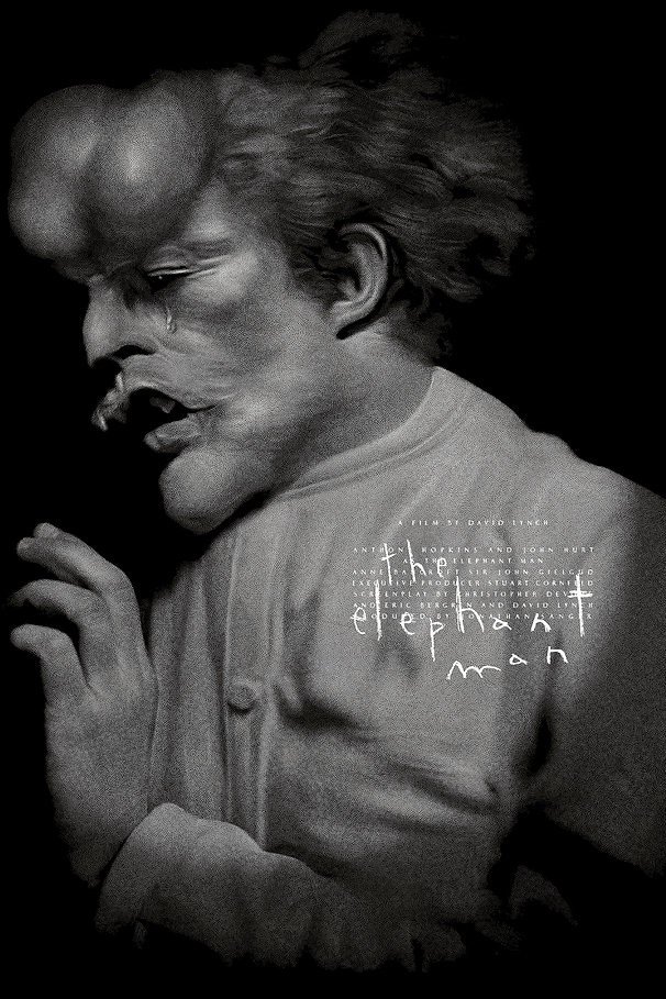 The Elephant Man