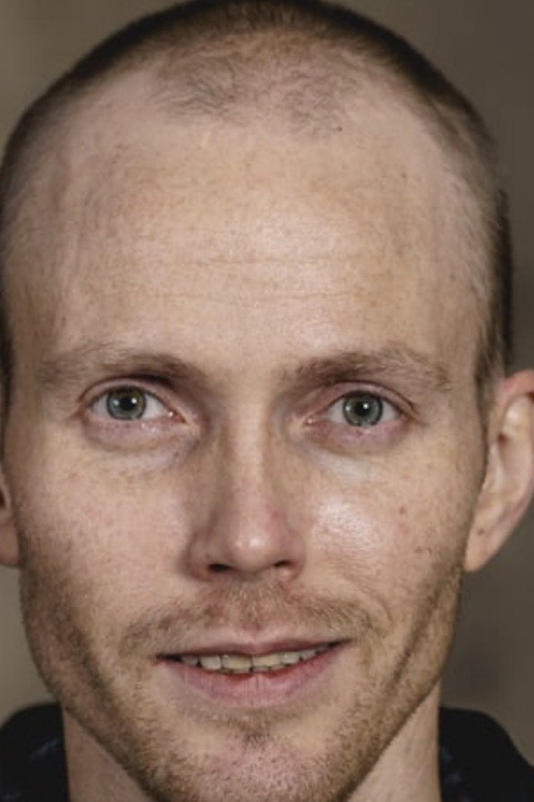 Bjørn Einar Romøren