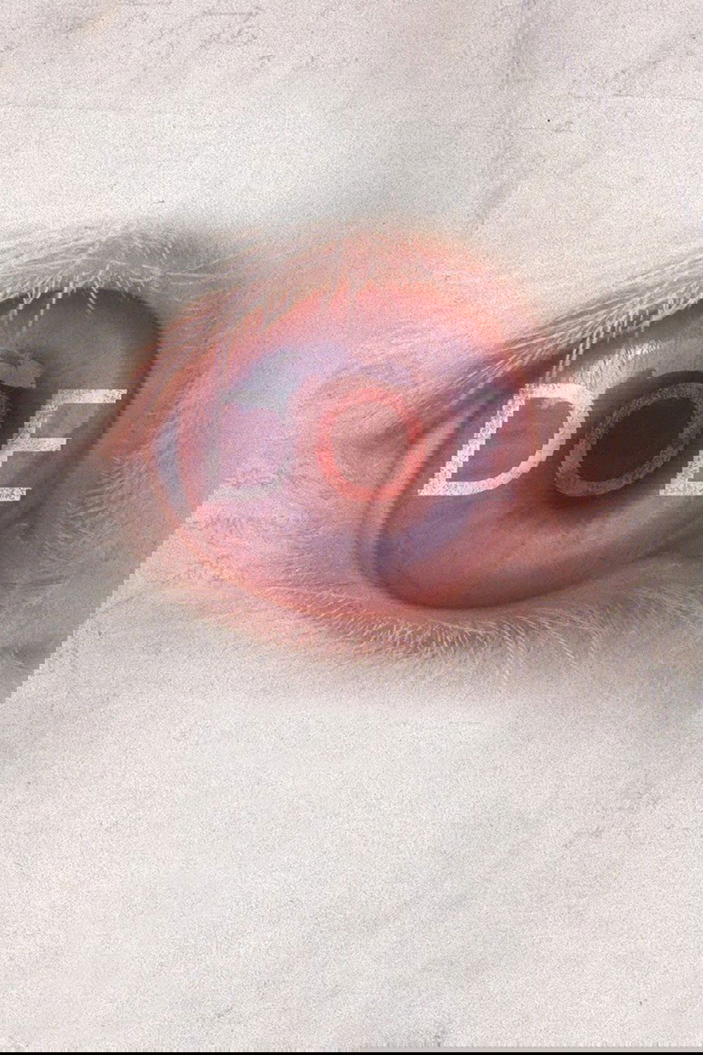 Doe