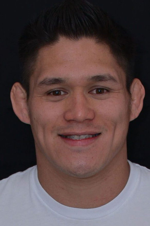 et billede af Herman Terrado