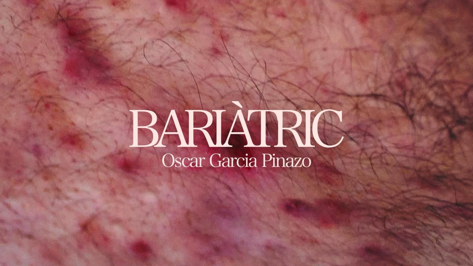 Bariàtric (2024)