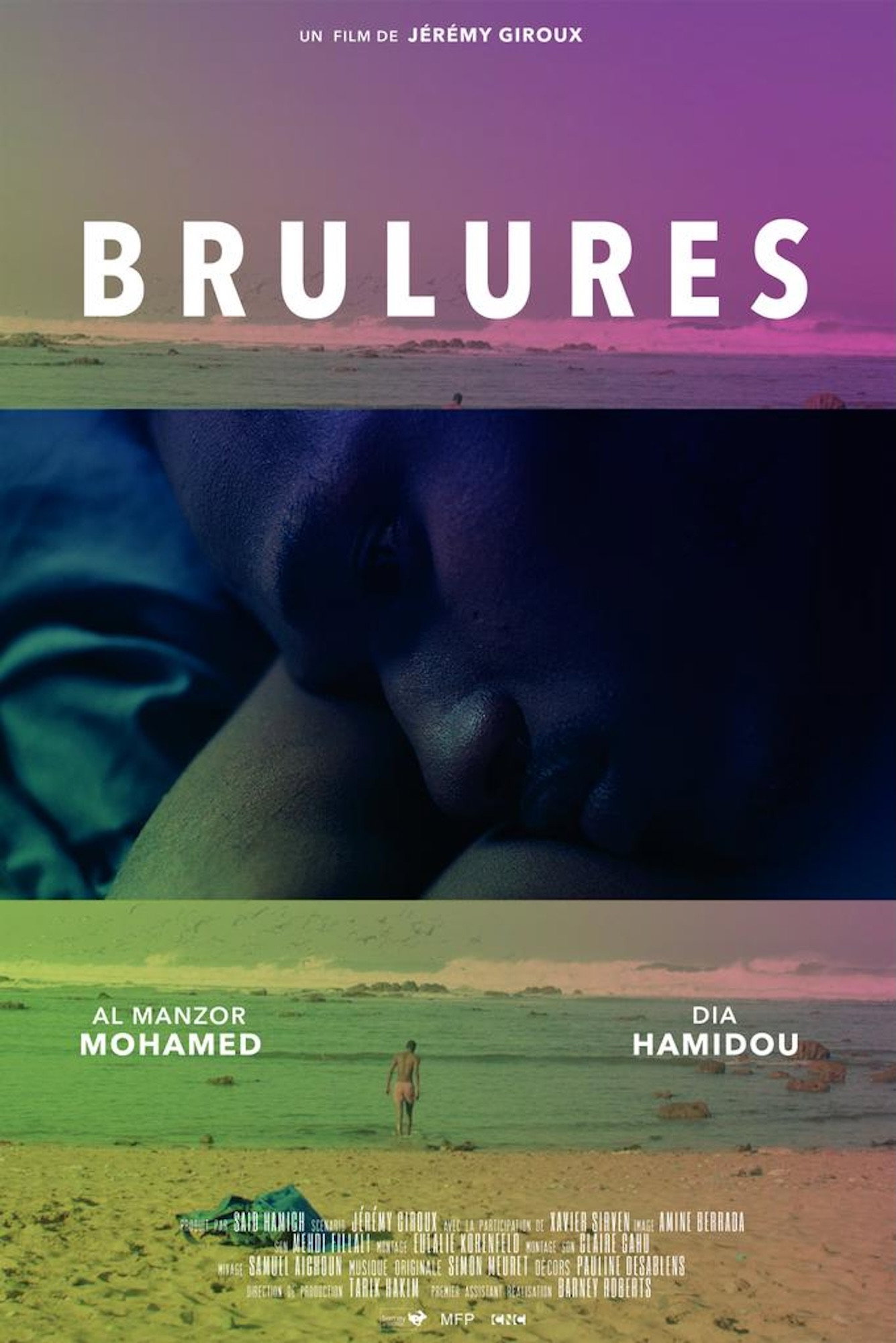 Brûlures