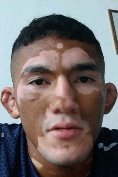 et billede af Melquizael Costa