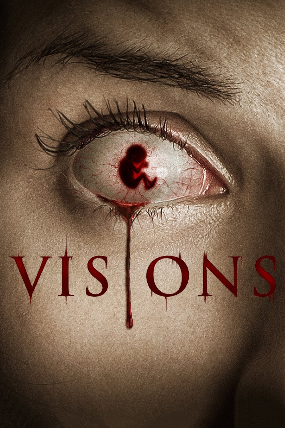 Visions