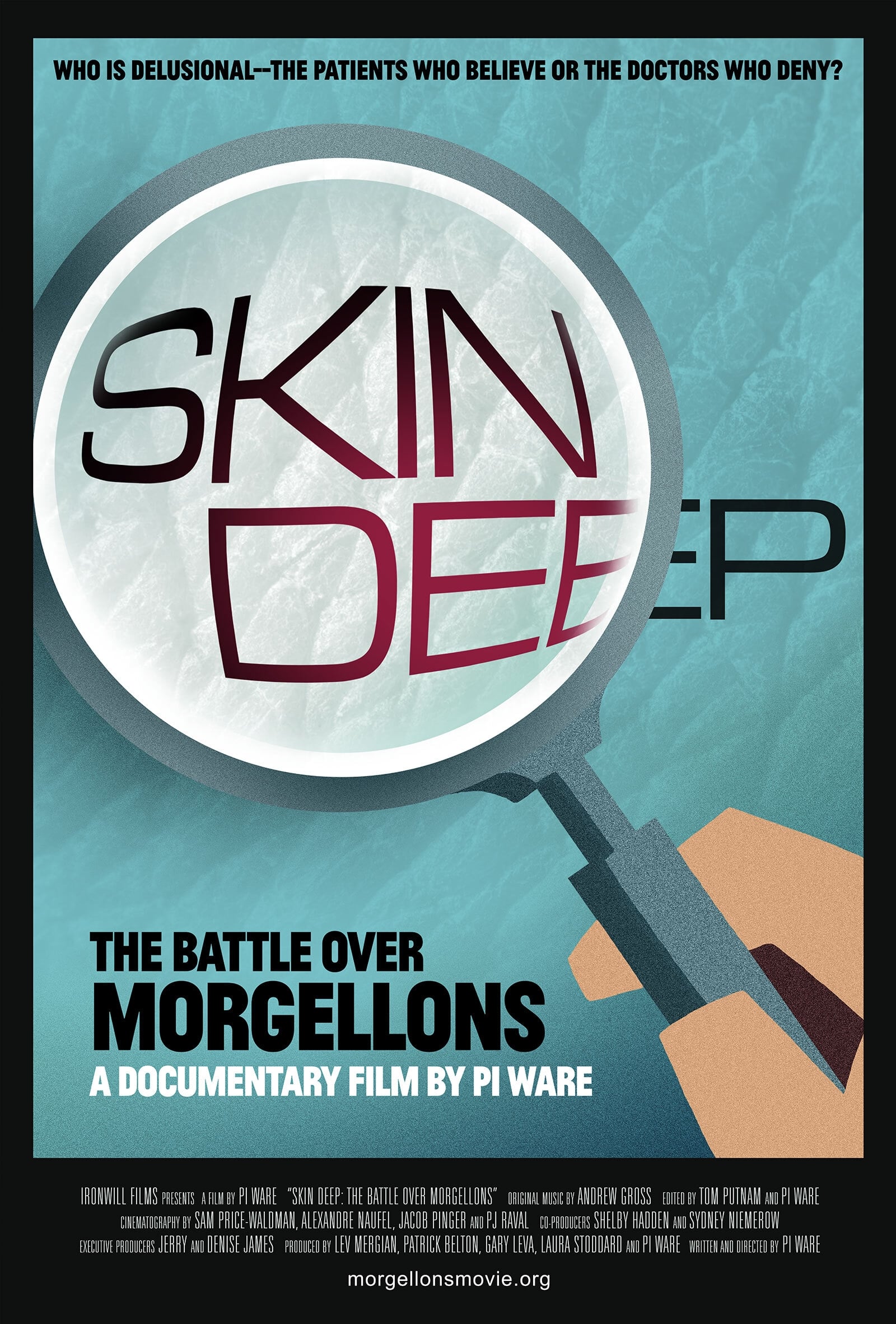 Skin Deep: The Battle Over Morgellons