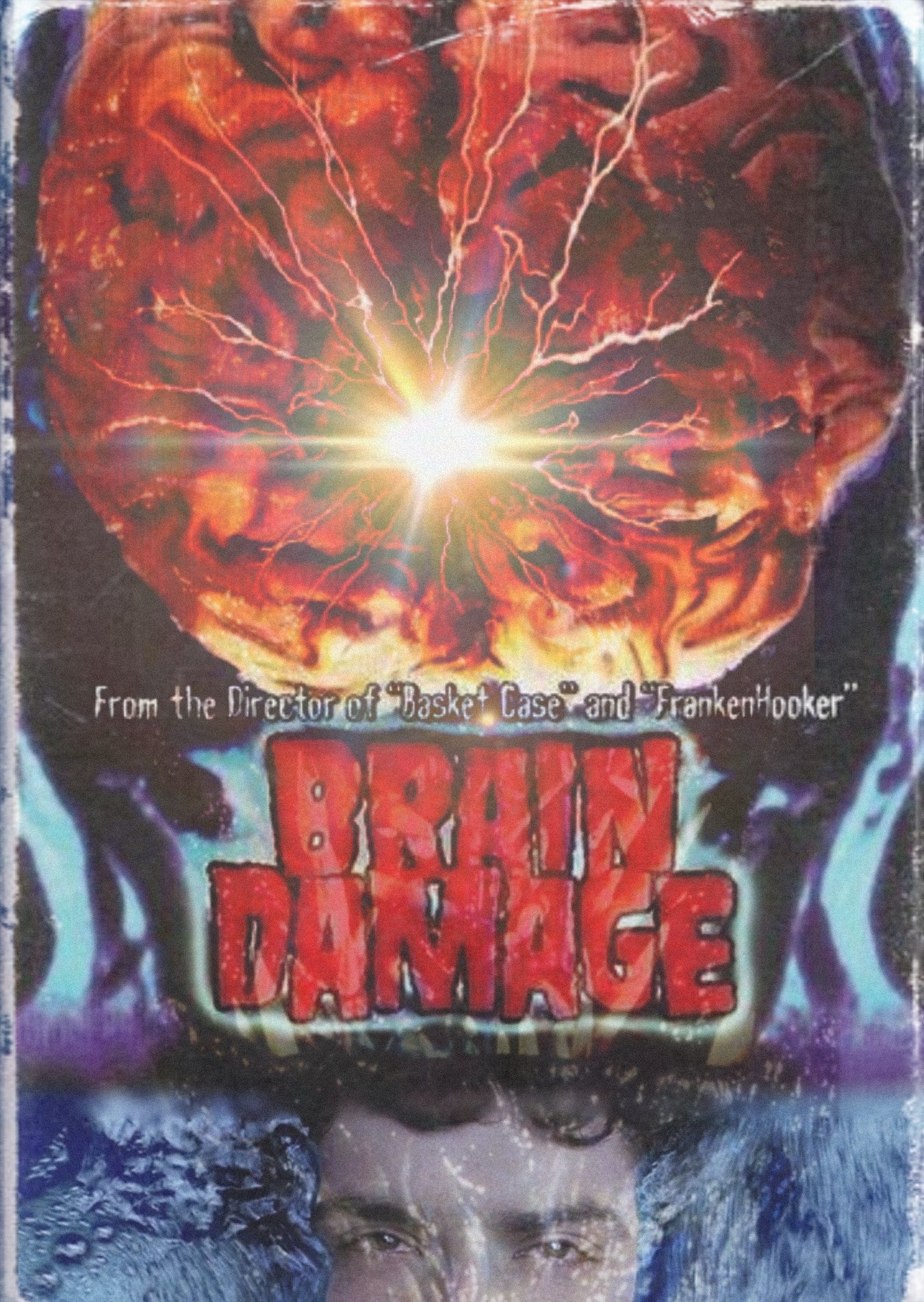 Brain Damage