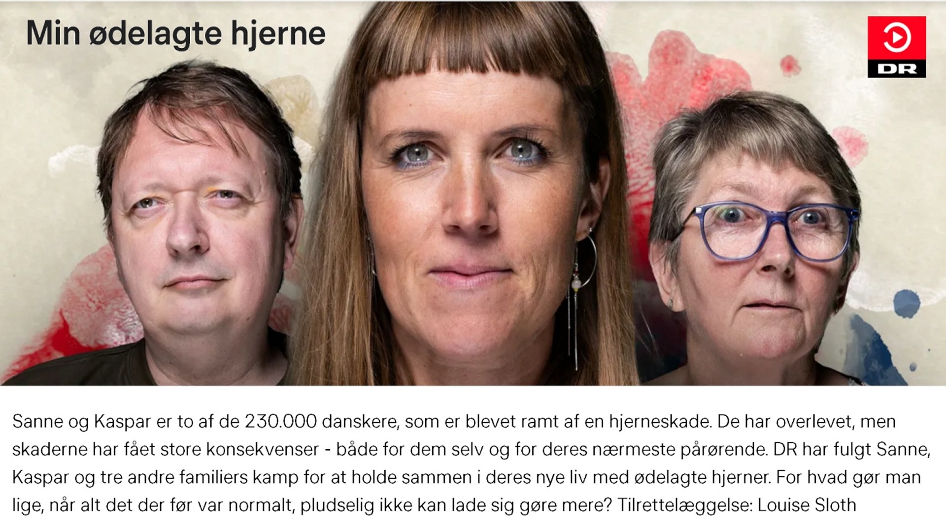 Min ødelagte hjerne - Season 1