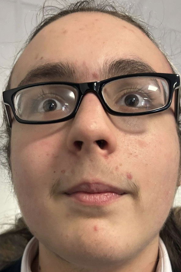 et billede af Calum Jess