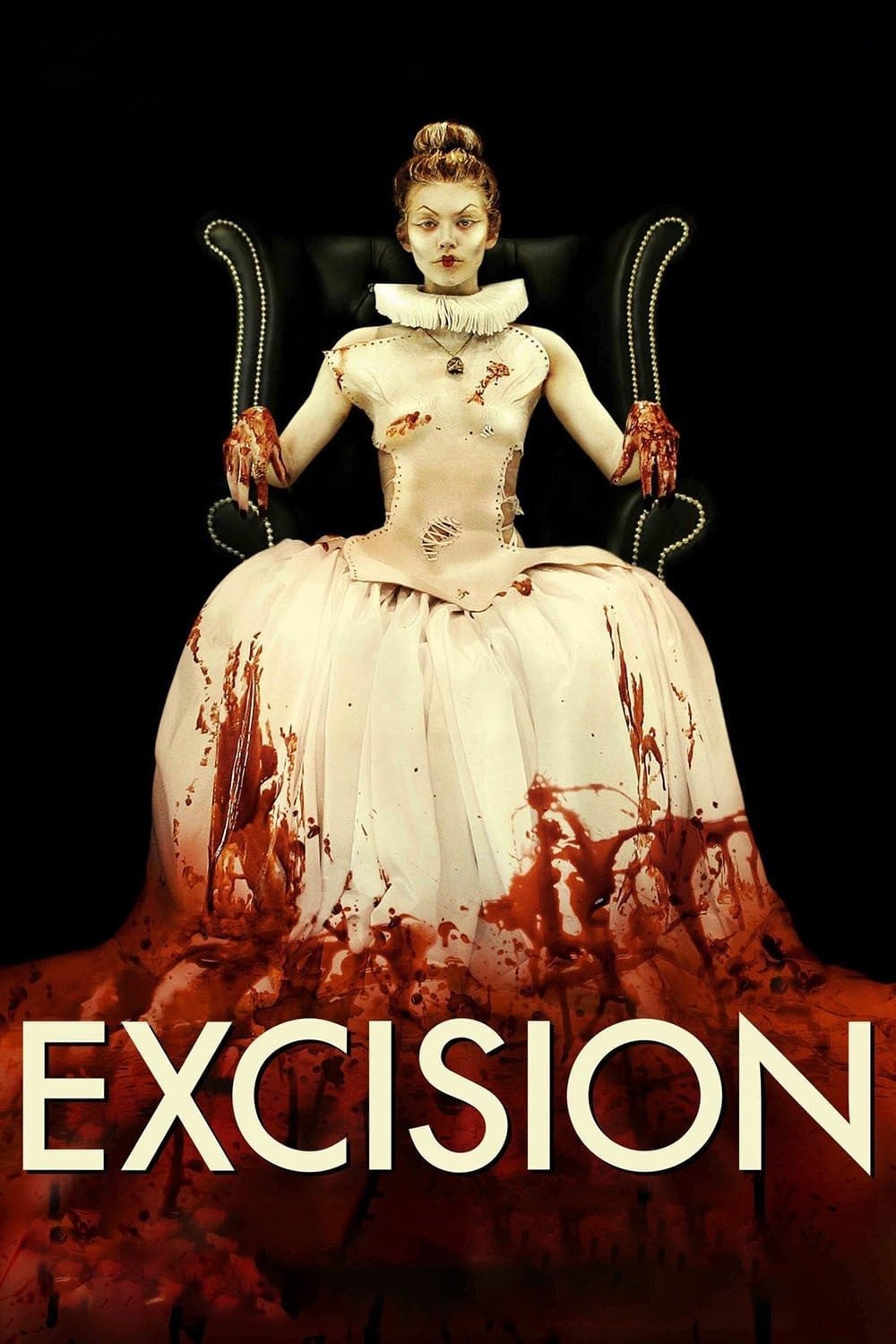 Excision