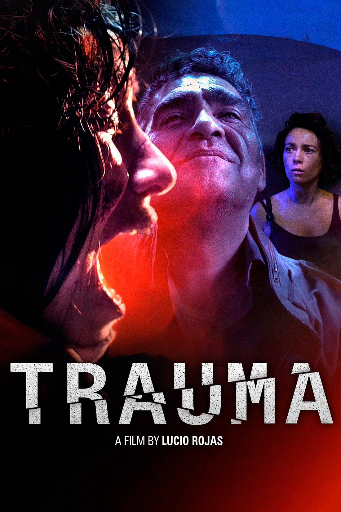 Trauma